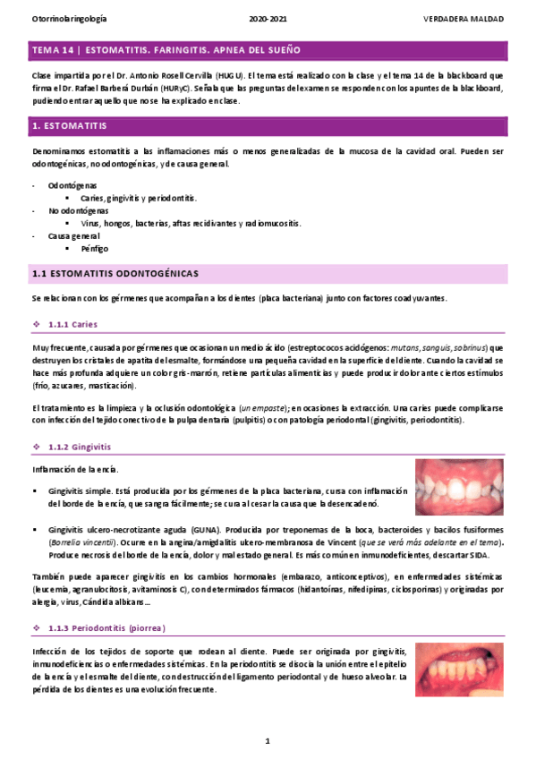 Miniatura del documento TEMA-14-ESTOMATITIS.pdf