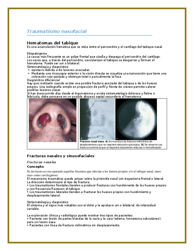 Miniatura del documento Trauma-NASOSINUSAL.docx