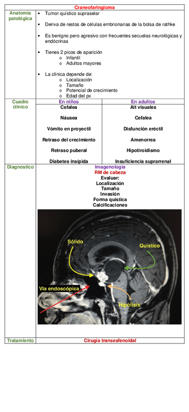 Miniatura del documento CUADRO-CRANEOFARINGIOMA.pdf