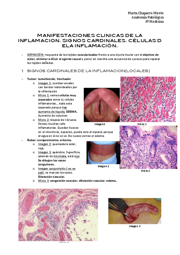 Miniatura del documento 1. MANIFESTACIONES CLINICAS DE LA INFLAMACION.pdf
