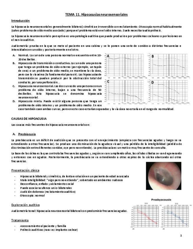 Miniatura del documento Tema 11. Hipoacusia neurosensorial.pdf