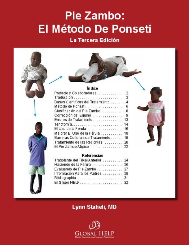 Miniatura del documento Tema-3-Metodo-Ponseti.pdf