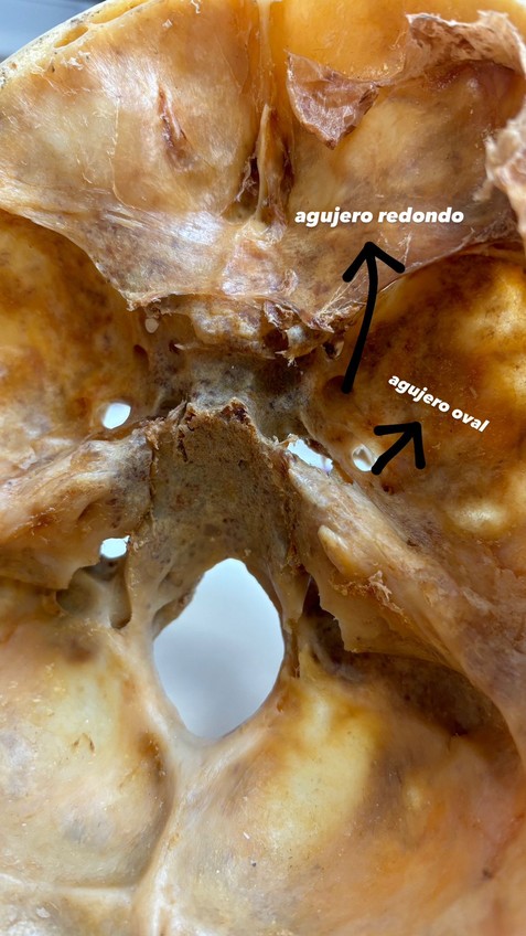 Miniatura del documento Agujero-redondo-y-oval.jpg