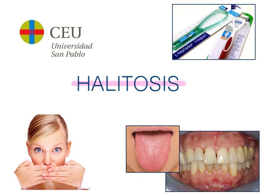 Miniatura del documento 10.-HALITOSIS.pdf