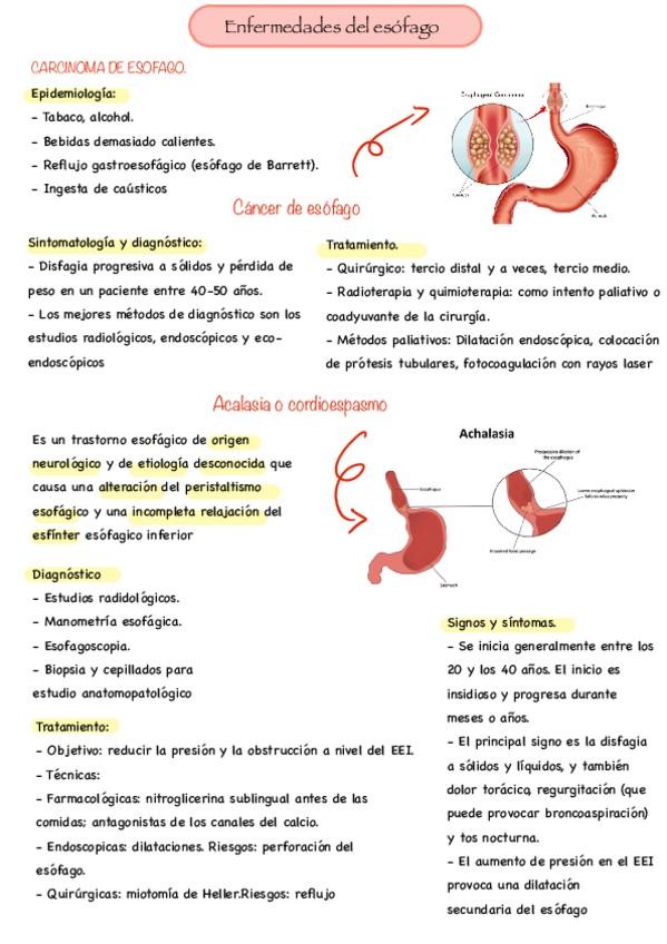 Miniatura del documento Enfermedades-del-esofago.pdf