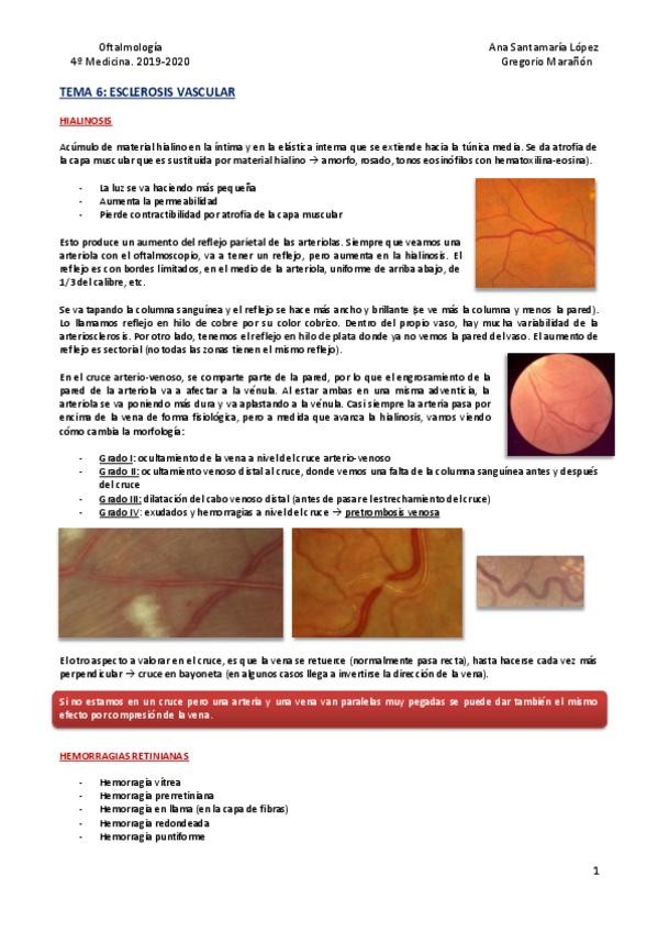 Miniatura del documento Tema-6-Esclerosis-vascular.pdf