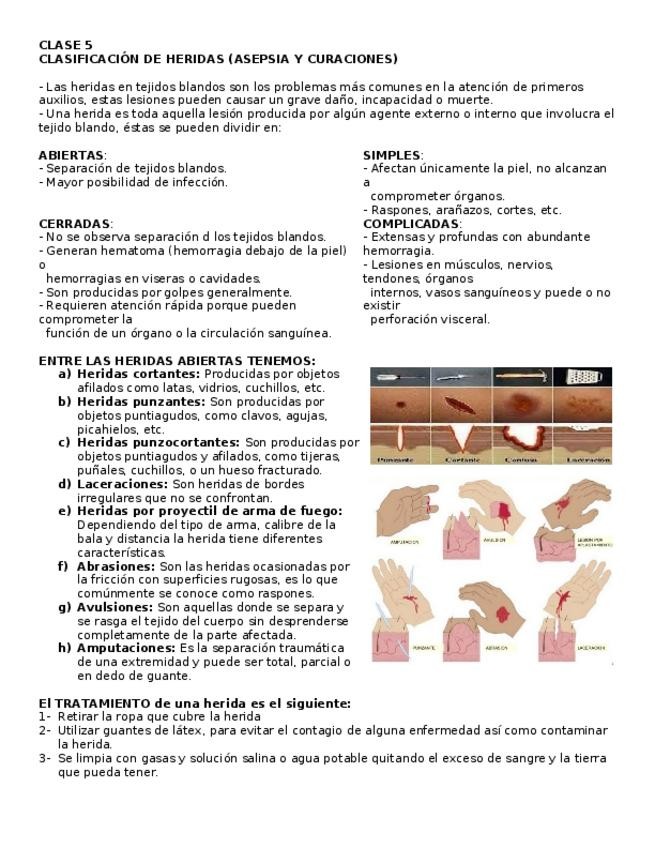 Miniatura del documento CLASIFICACION-DE-HERIDAS-ASEPSIA-Y-CURACIONES.docx