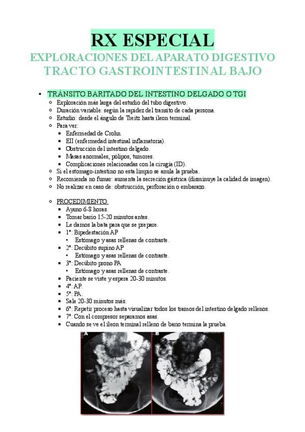 Miniatura del documento RESUMEN-TEMA-4.pdf