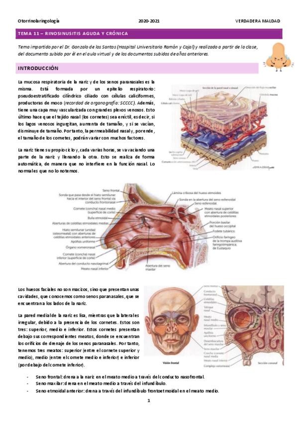 Miniatura del documento TEMA-11-RINOSINUSITIS-AGUDA-Y-CRONICA.pdf