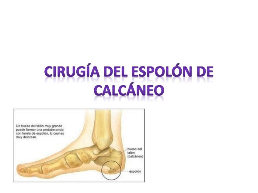 Miniatura del documento espolon-.pdf