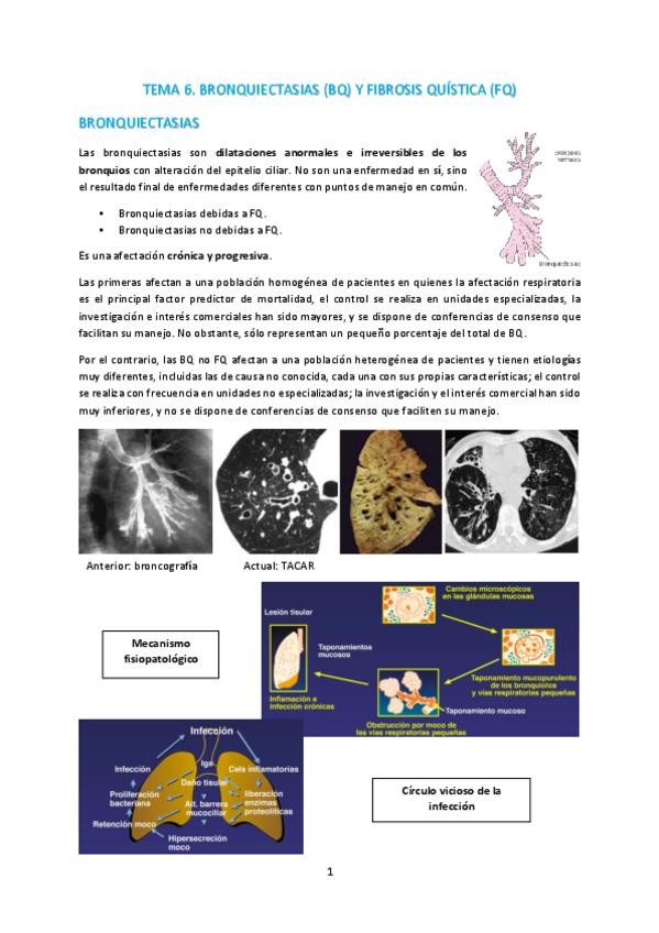 Miniatura del documento T6-Bronquiectasias-y-fibrosis-quistica.pdf