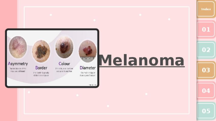 Miniatura del documento MELANOMA.pptx