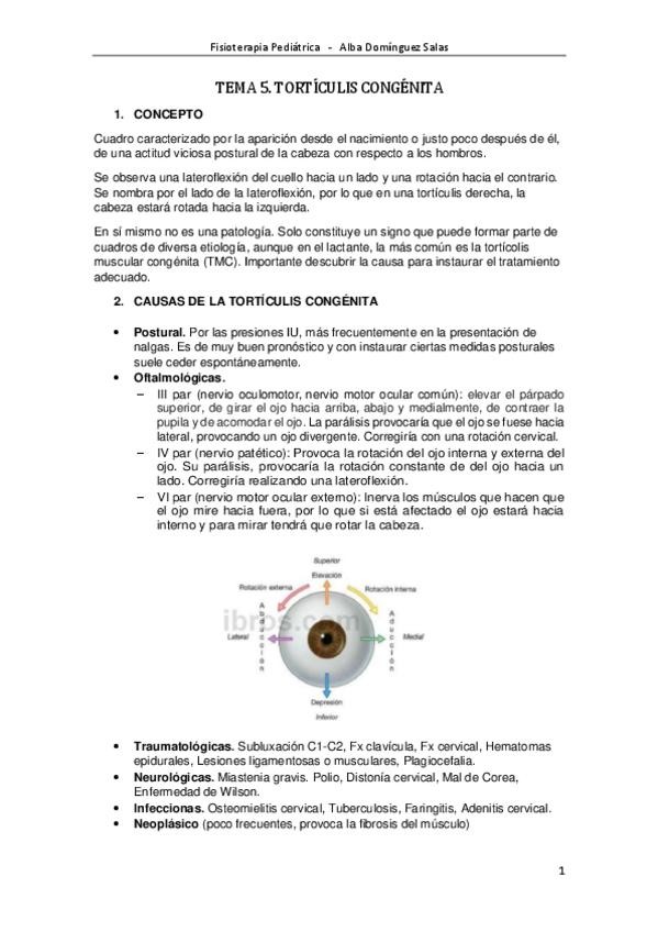 Miniatura del documento TEMA 5. TORTÍCULIS CONGÉNITA.pdf