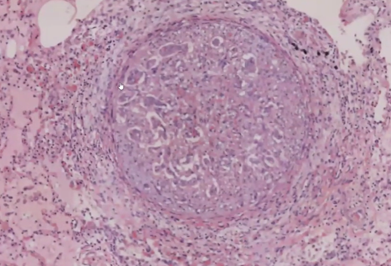 hartavirus
