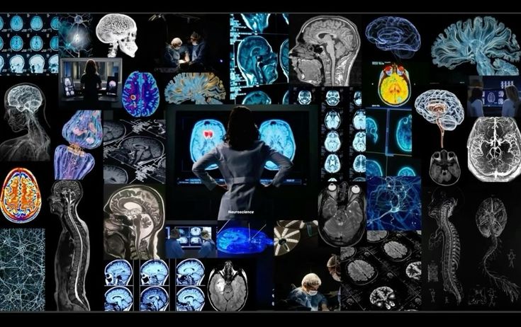 neurouaber